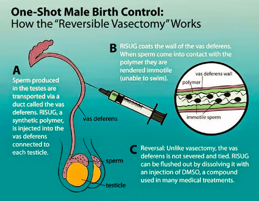 Birth Control For Men 99