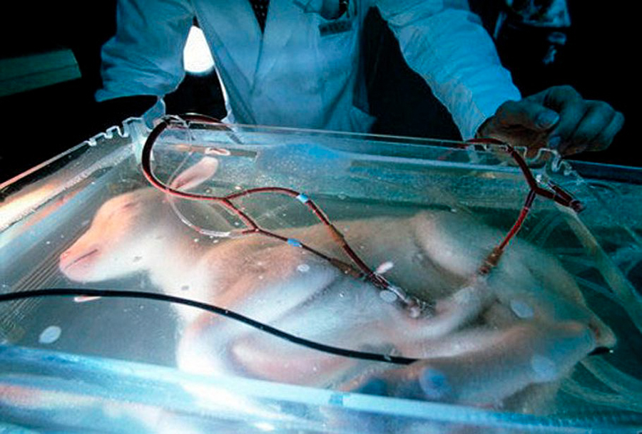 2_artificial womb