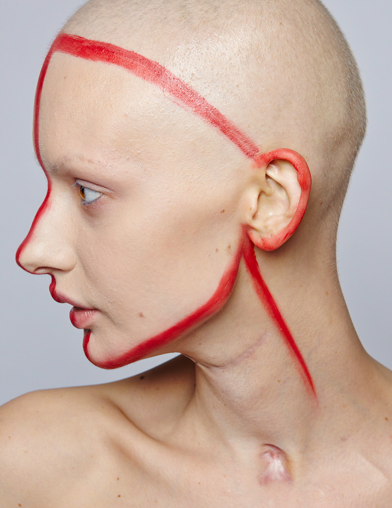 3_model who lost her jaw to cancer